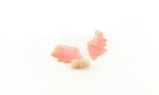 common-causes-of-denture-damage