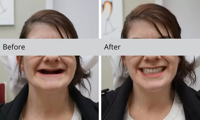 before and after