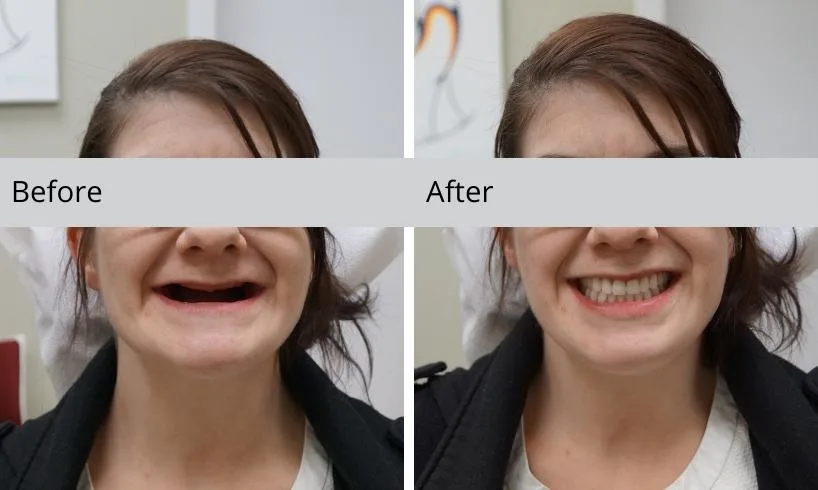 before and after