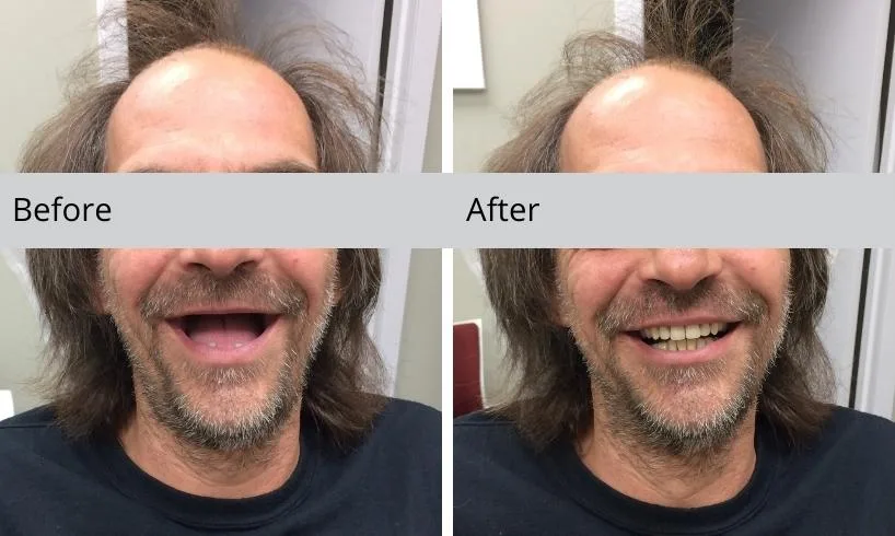 before and after
